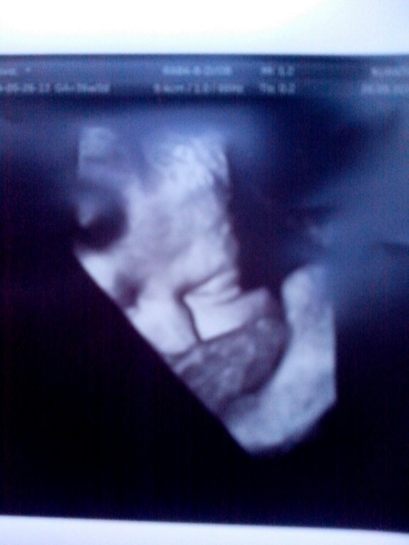 36 недельный отчёт и фотки