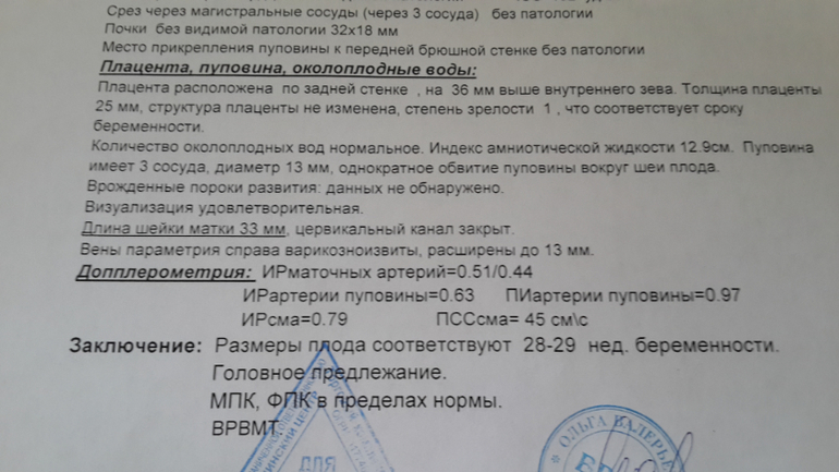 30 неделек ( наше УЗИ)