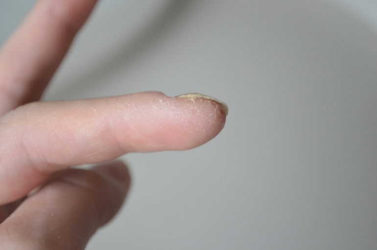 Что может быть с пальцем? Может у кого было