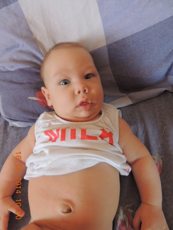 Опять про грыжу