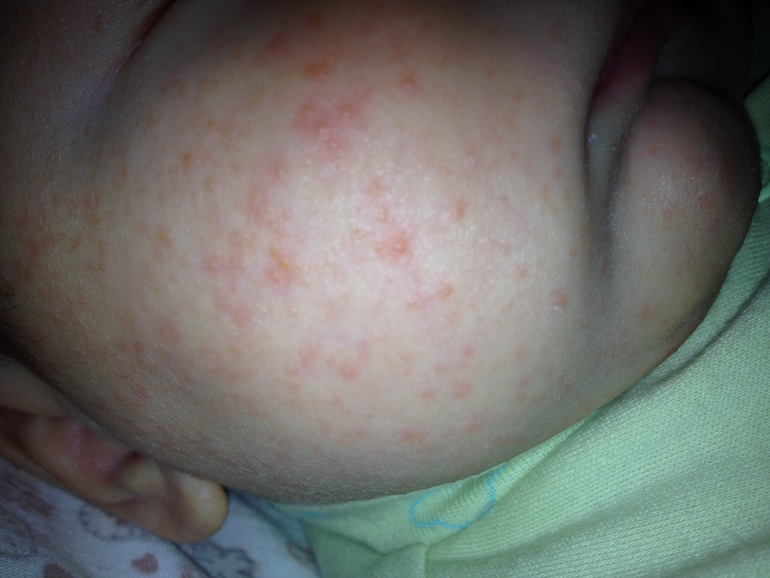 Этот ужас называется