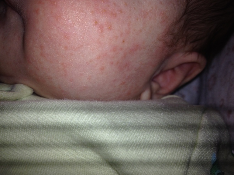 Этот ужас называется