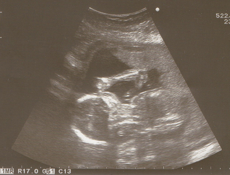 Вот и пролетела половина нашей беременности=)