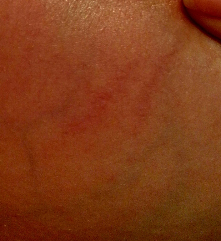 РАСТЯЖКИ!?!?!?!