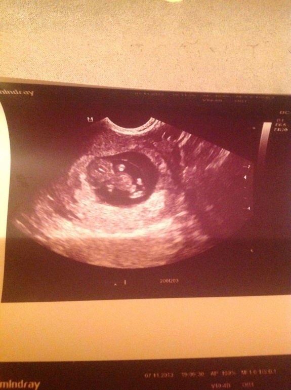 9,5 недель "фотоотчет"