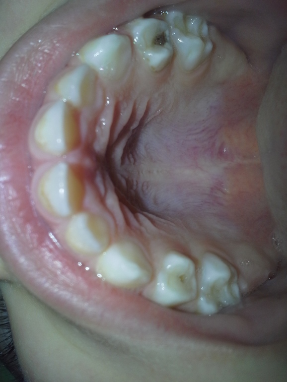 Лечение без общего наркоза