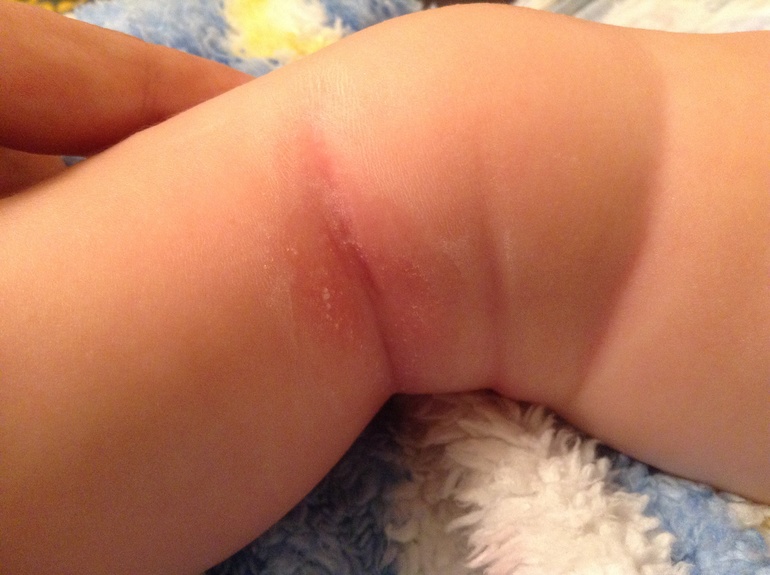 Здравтвуйте