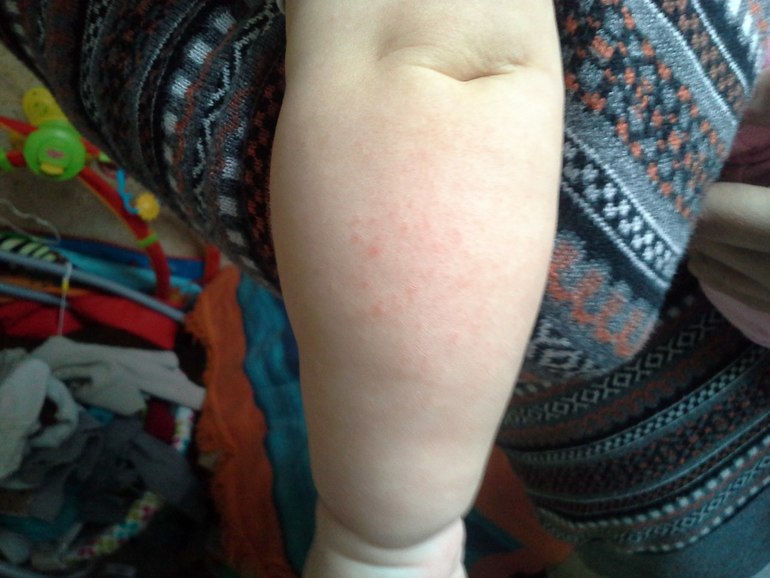 помогите!!! прикорм