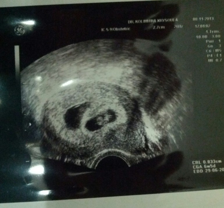 Мои головастики))