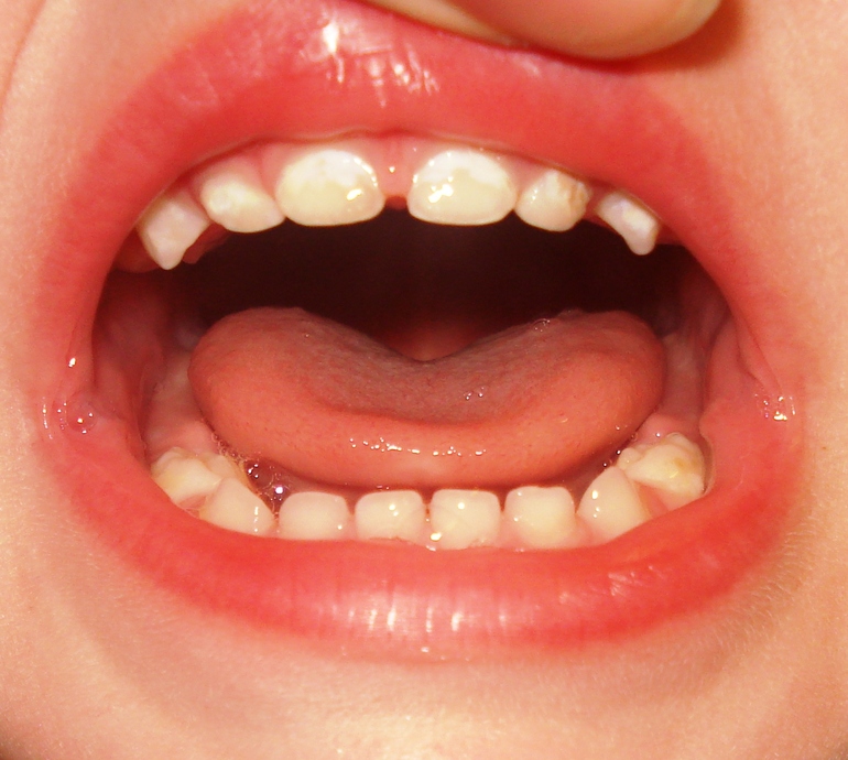 Скажите пожалуйста, что с зубками?????