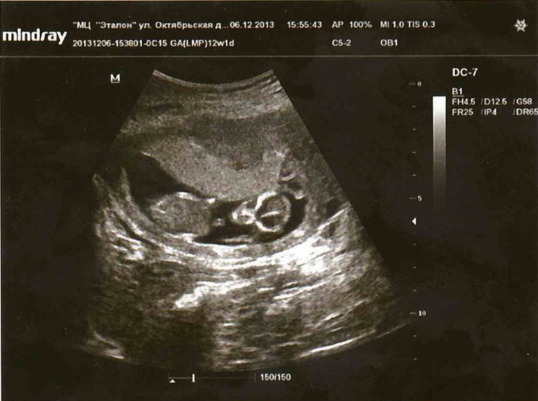 Помогите определить мальчик или девочка!!