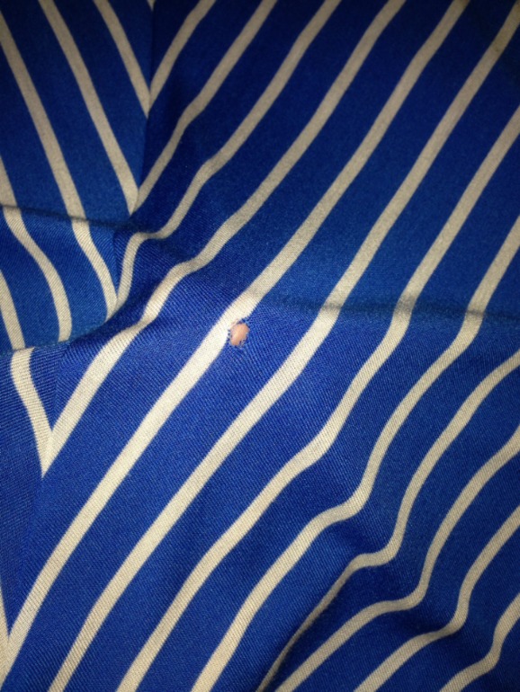 Как зашить дырку?