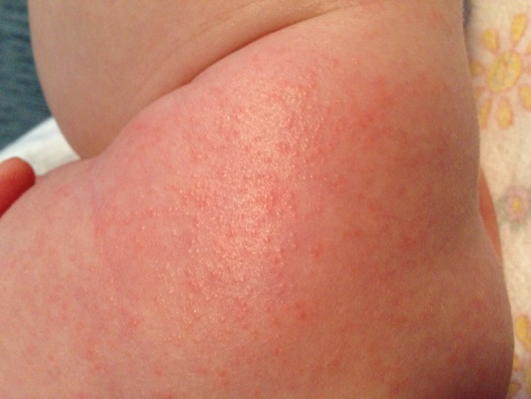 Девочки, подскажите, пожалуйста, что это может быть?