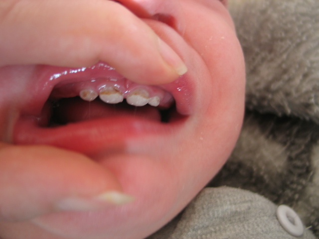 Поогите поставить диагноз