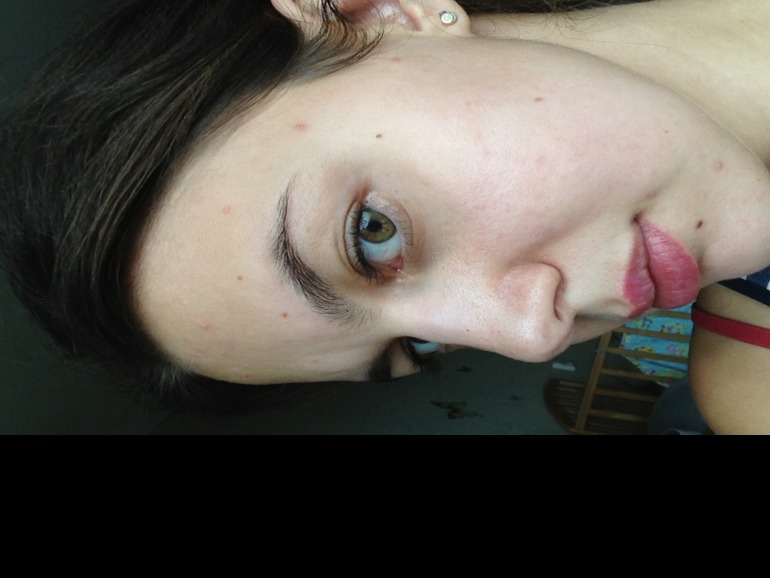 Помогите справиться с прыщами!!я уже не знаю,что мне делать((