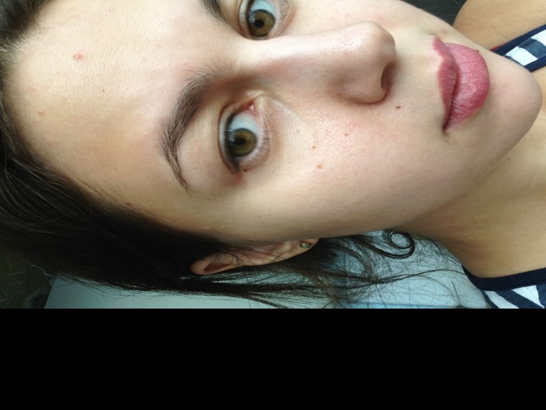 Помогите справиться с прыщами!!я уже не знаю,что мне делать((