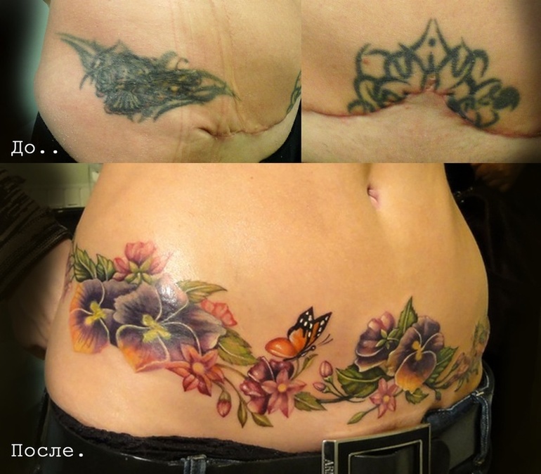 Татуировки на шрамах - фото перекрытия тату рубцов | Tattoo Academy