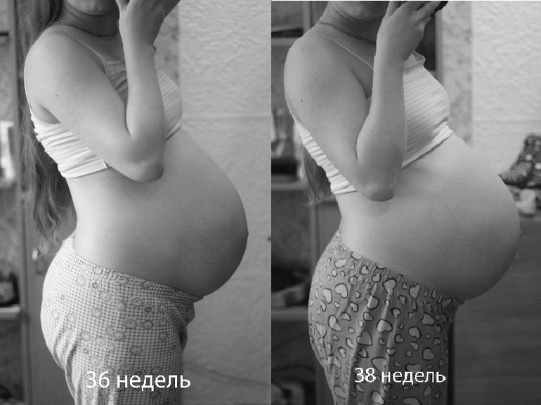 Как понять что живот опустился перед родами у первородящих фото до и после