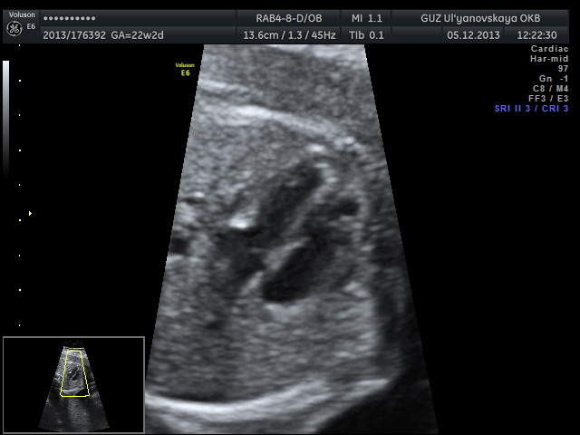 Наша умничка!!! ( немного фото)