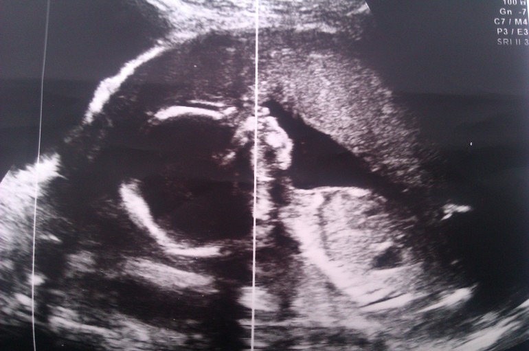 наше счастье (продолжение)