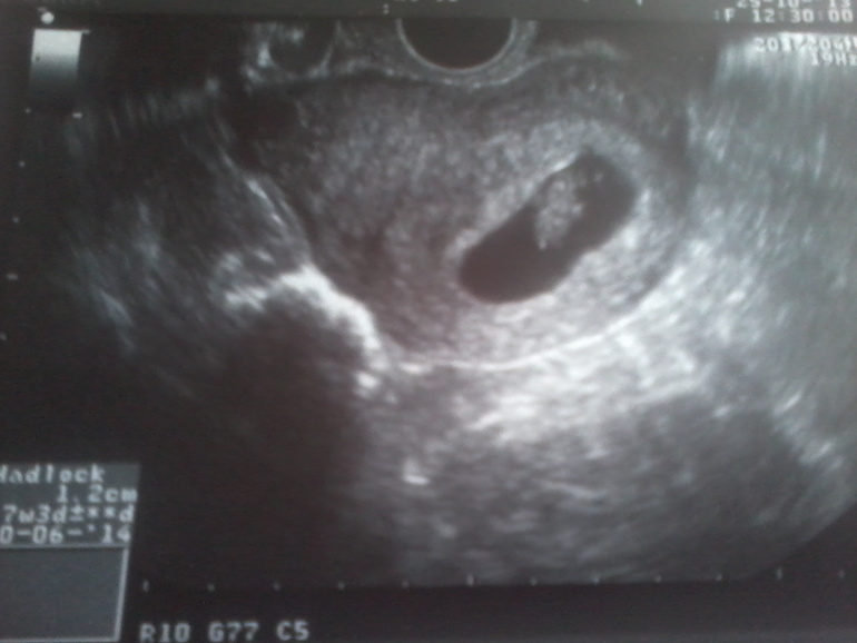 Я так счастлива!!!!