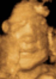 Фото УЗИ на 34 неделе беременности