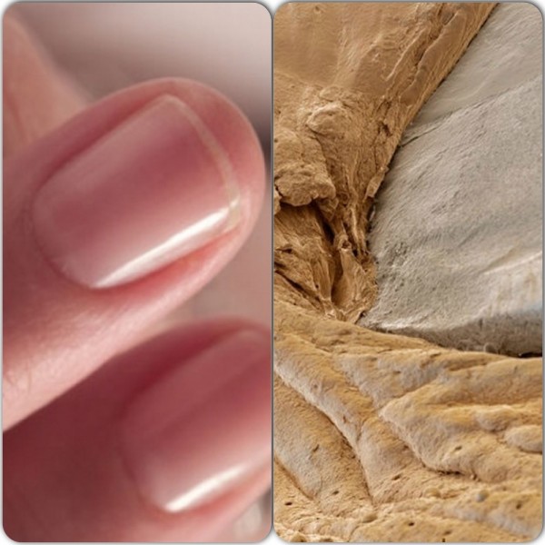 Кутикула ногтя под микроскопом. Щетка под микроскопом. Человеческий волос под микроскопом. Бактерии под микроскопом. Клещ demodex folliculorum микроскоп.