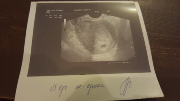 Беременность 3 5 года. Снимок УЗИ 3 месяца беременности на мониторе. УЗИ беременности на ранних сроках 3-4 недели. Снимок УЗИ беременности 3 неделя беременности. УЗИ беременности 5 неделя беременности.