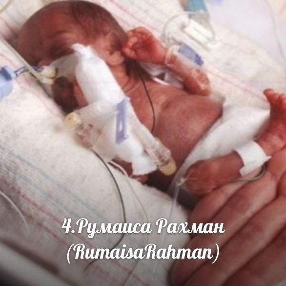 Самые необычные дети мира