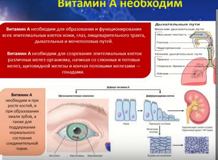 Гипервитаминоз д картинки