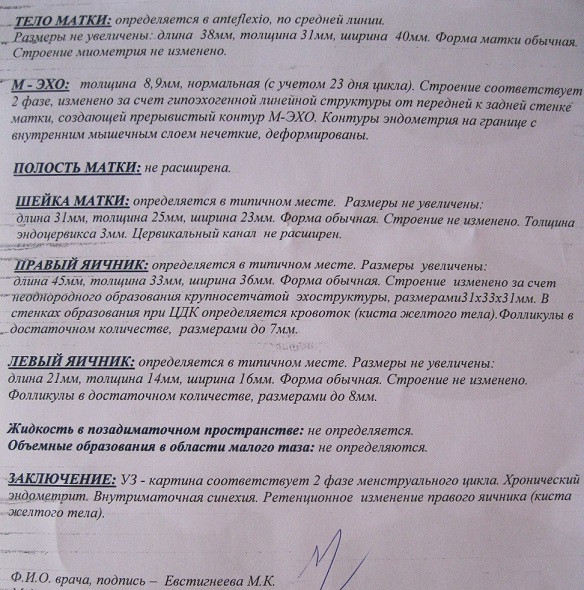 Я в расстройстве, это ничего не сказать...