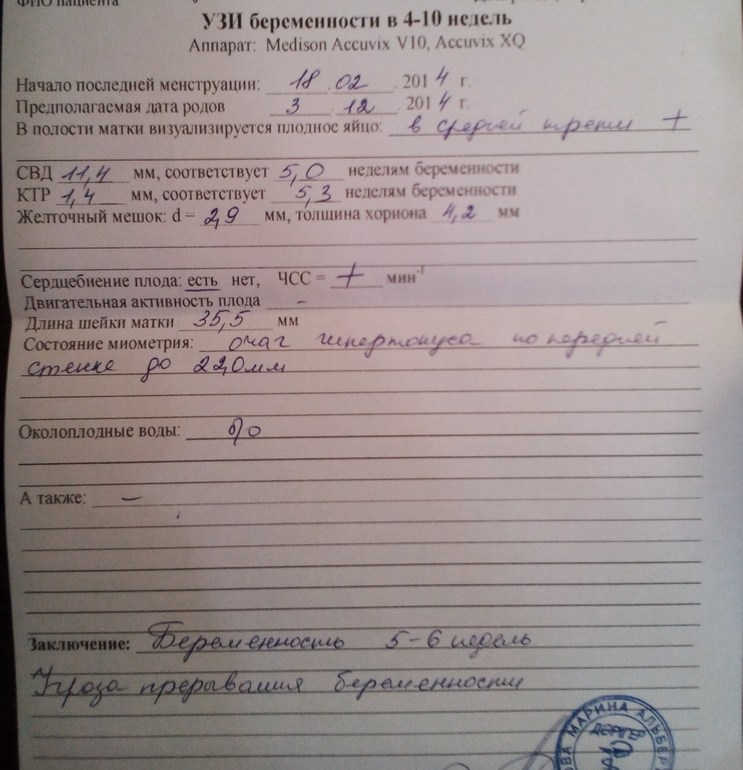 Маленький,но есть !!!!!!!!!!!