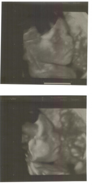 Фото УЗИ на 27 неделе беременности