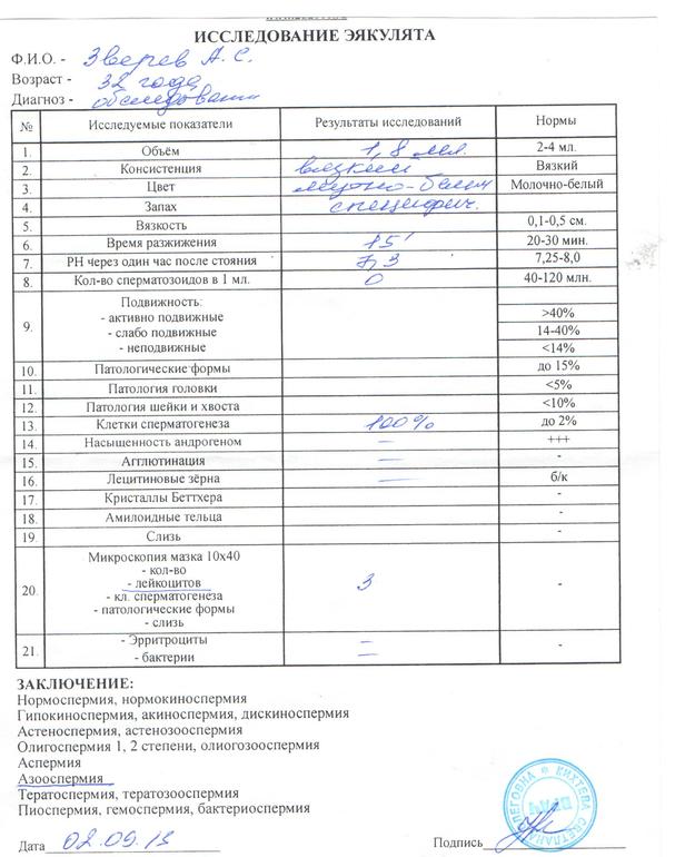 Азооспермия как Приговор