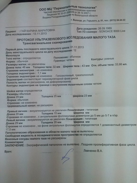13 день цикла. УЗИ =)