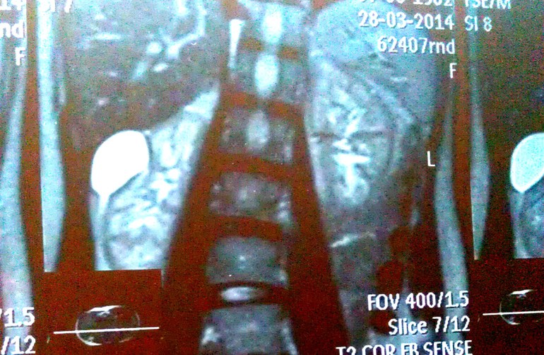 Новости с полей