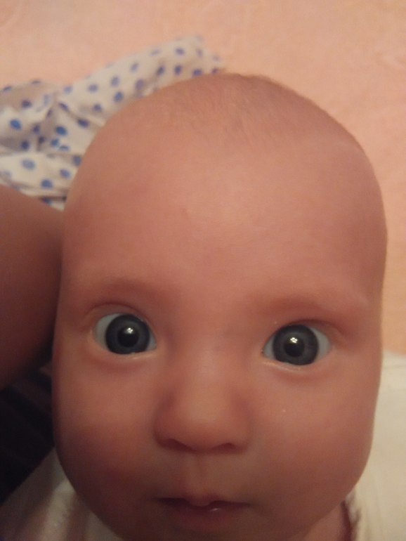 Белки глаз новорожденного. Голубые склеры у младенца. Голубые склеры у грудничка. Голубой оттенок склер у новорожденного. Цвет глаз у новорожденных.