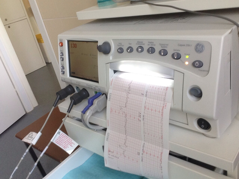 15 РД (Шарикопотшибниковская)