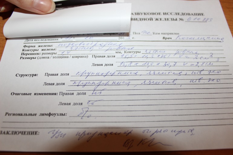 Подковообразная щитовидная железа