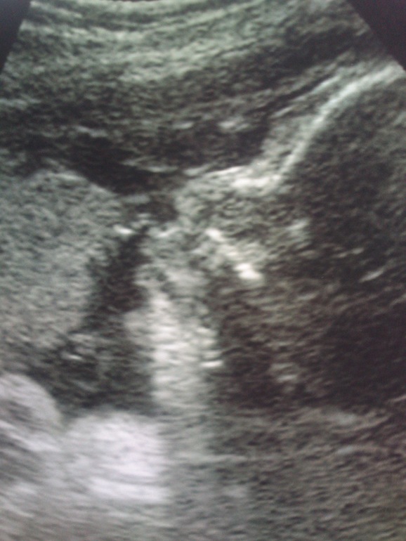 33 неделя,ЖК,УЗИ....достали