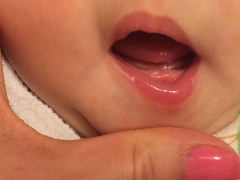 Наши 2 зубика