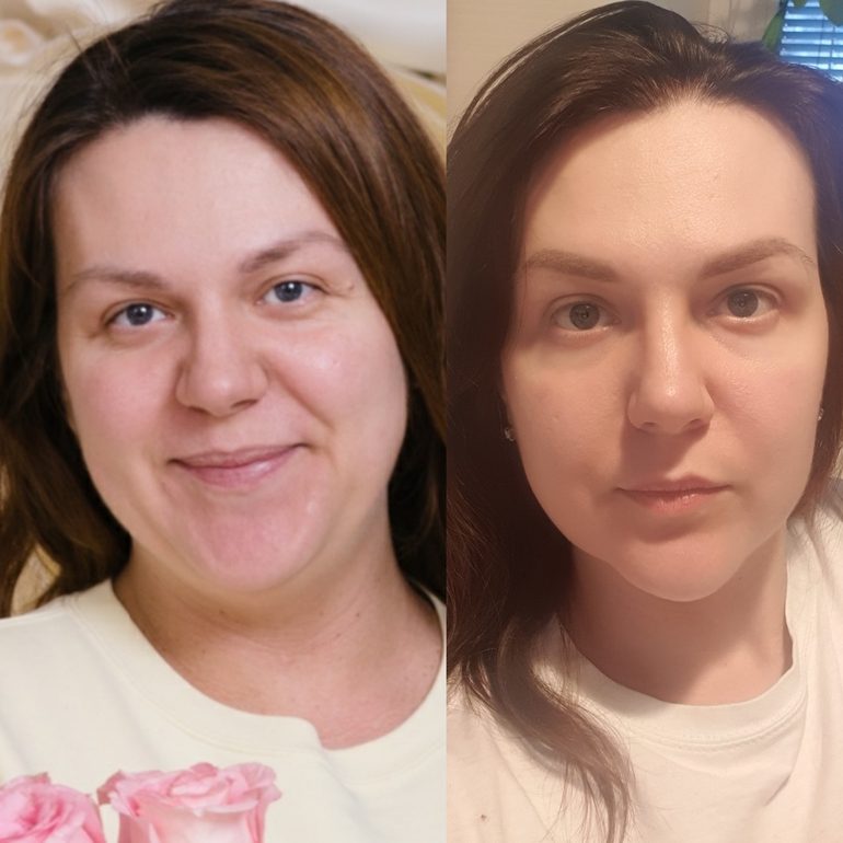 Как меняется лицо после отказа от алкоголя у женщин фото до и после