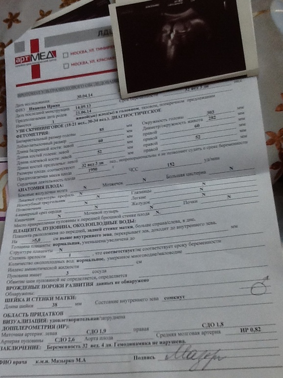 Сангвинник ( 3ье узи)