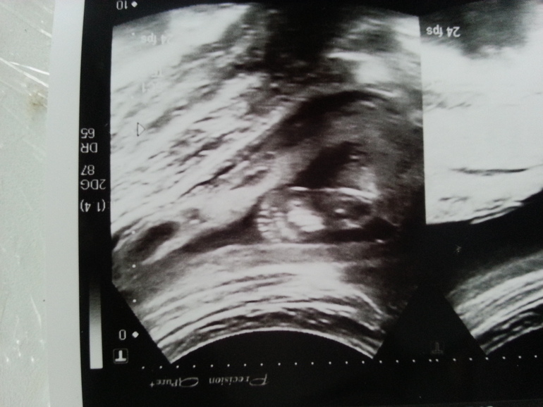 Мой экватор...