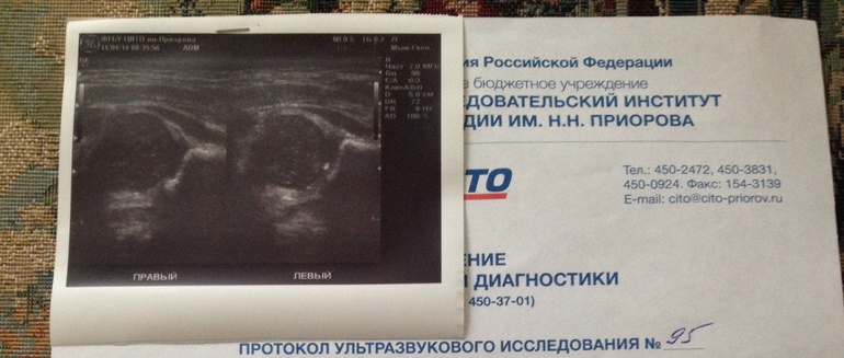 Дисплазия???