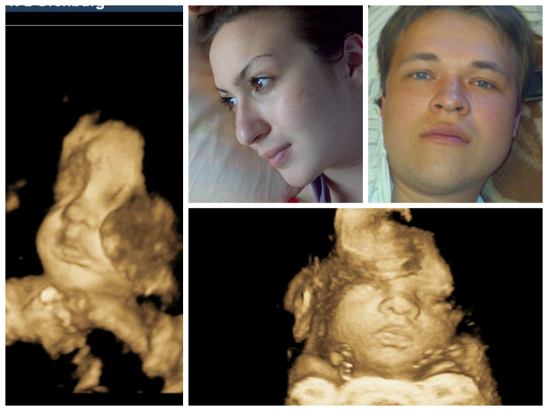 Я подарю тебе дочь, можно?! Наше 3 скрининговое УЗИ!