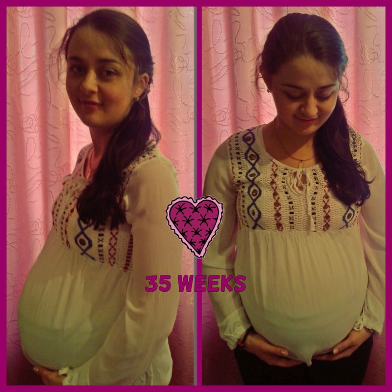 Началась 36 неделька :)