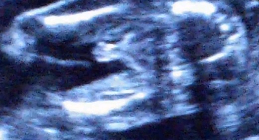 Мальчик или девочка?!