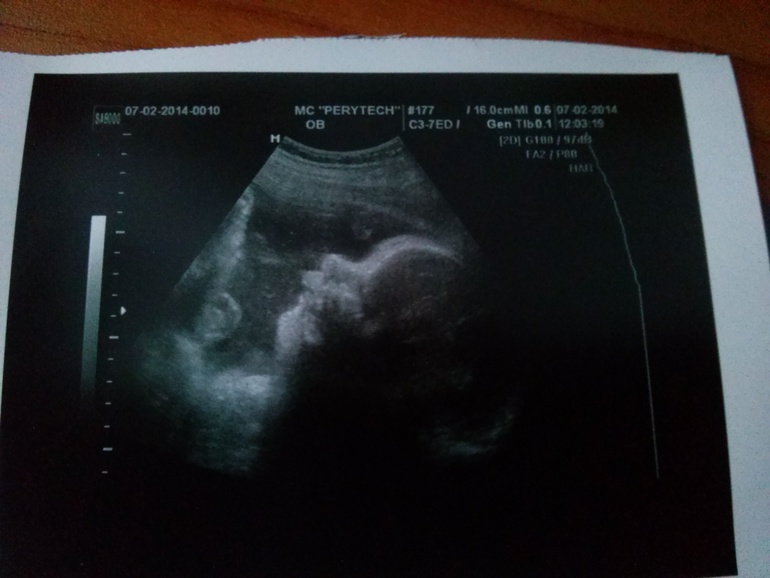 сходили на плановое узи!)