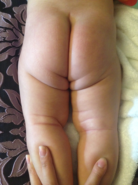 Наши складочки